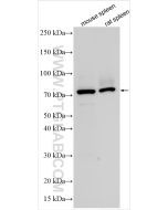 CD126/IL-6R alpha Polyclonal antibody proteintech 23457-1-AP