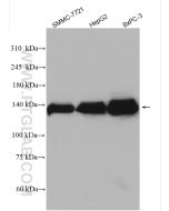 MGEA5 Polyclonal antibody proteintech 14711-1-AP