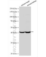 FECH Polyclonal antibody proteintech 14466-1-AP