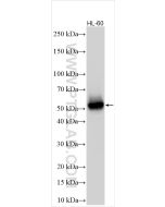 CD14 Polyclonal antibody proteintech 30796-1-AP