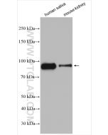 TGM1 Polyclonal antibody proteintech 12912-3-AP