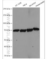 LSS Polyclonal antibody proteintech 13715-1-AP