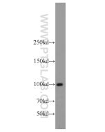 LIG4 Polyclonal antibody proteintech 12695-1-AP