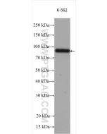 PDE4D Polyclonal antibody proteintech 12918-1-AP