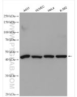 RRM2 Polyclonal antibody proteintech 11661-1-AP