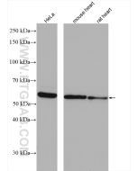 TXNRD1 Polyclonal antibody proteintech 11117-1-AP