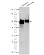 ICAM-1/CD54 Polyclonal antibody proteintech 16174-1-AP