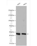 Cyclin B2 Polyclonal antibody proteintech 21644-1-AP