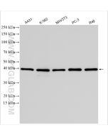 CSNK2A1 Polyclonal antibody proteintech 10992-1-AP