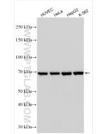 Angiopoietin 2 Polyclonal antibody proteintech 24613-1-AP