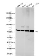 ACSL3 Polyclonal antibody proteintech 20710-1-AP
