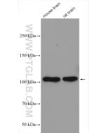 CYLD Polyclonal antibody proteintech 11110-1-AP