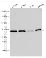 MMP2 Polyclonal antibody proteintech 10373-2-AP