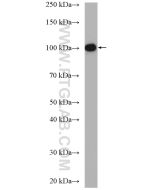 MCM3 Polyclonal antibody proteintech 15597-1-AP