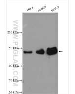 PERK/EIF2AK3 Polyclonal antibody proteintech 24390-1-AP