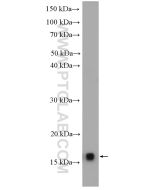 SSBP1 Polyclonal antibody proteintech 12212-1-AP