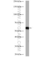 ETV4 Polyclonal antibody proteintech 10684-1-AP