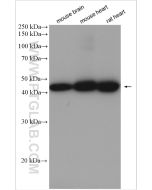 UQCRC2 Polyclonal antibody proteintech 14742-1-AP