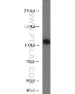 FUT4 Polyclonal antibody proteintech 19497-1-AP