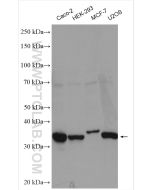 Cyclin D2 Polyclonal antibody proteintech 10934-1-AP