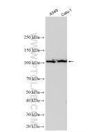 OGDH Polyclonal antibody proteintech 15212-1-AP