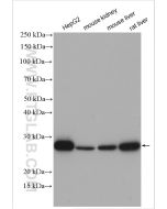 VAPA Polyclonal antibody proteintech 15275-1-AP