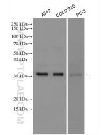 MMP7 Polyclonal antibody proteintech 10374-2-AP