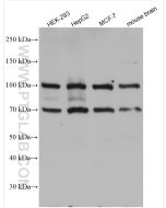 FBXW7 Polyclonal antibody proteintech 28424-1-AP