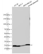 Claudin 4-specific Polyclonal antibody proteintech 16195-1-AP