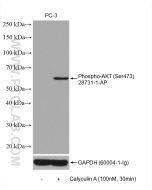 Phospho-AKT (Ser473) Polyclonal antibody proteintech 28731-1-AP