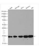 PGAM1 Polyclonal antibody proteintech 16126-1-AP