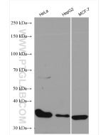 CDK4 Polyclonal antibody proteintech 11026-1-AP