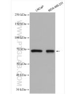 MMP-9 (N-terminal) Polyclonal antibody proteintech 10375-2-AP