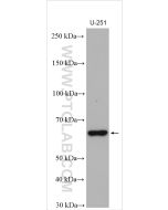 NOXA2/p67phox Polyclonal antibody proteintech 15551-1-AP
