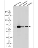 Mmp8 Polyclonal antibody proteintech 33084-1-AP