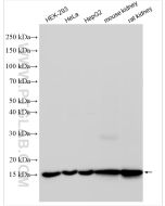 TOM20 Polyclonal antibody proteintech 11802-1-AP