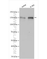 NFATC3 Polyclonal antibody proteintech 18222-1-AP