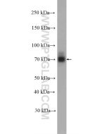NR4A1 Polyclonal antibody proteintech 25851-1-AP