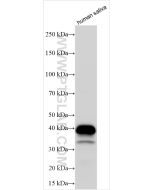 Carbonic Anhydrase 6/CA6 Polyclonal antibody proteintech 32740-1-AP
