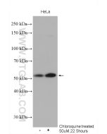 ATG5 Polyclonal antibody proteintech 10181-2-AP