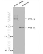 APOB Polyclonal antibody proteintech 20578-1-AP