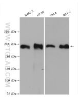 Integrin beta 4 Polyclonal antibody proteintech 21738-1-AP