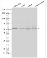 PFKFB3 Polyclonal antibody proteintech 13763-1-AP