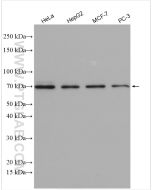 ETV5 Polyclonal antibody proteintech 13011-1-AP