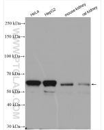 IGF2BP2 Polyclonal antibody proteintech 11601-1-AP