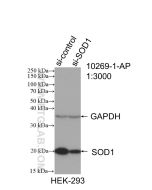 SOD1 Polyclonal antibody proteintech 10269-1-AP