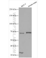 GNRHR Polyclonal antibody proteintech 19950-1-AP