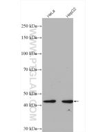 FBXO22 Polyclonal antibody proteintech 13606-1-AP