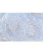 PD-1/CD279 Polyclonal antibody proteintech 18106-1-AP