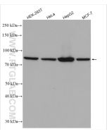 P5CS Polyclonal antibody proteintech 17719-1-AP